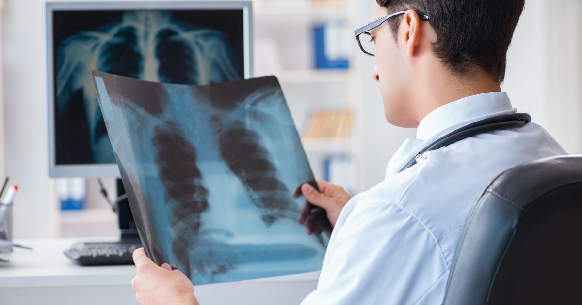 Lung Cancer Awareness Month: Why It’s Important